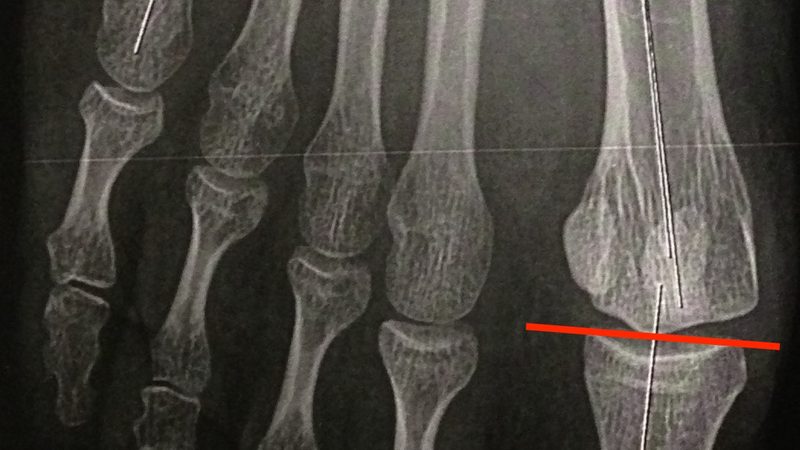 碳陶瓷刹车盘：揭秘其使用寿命与维护要点
